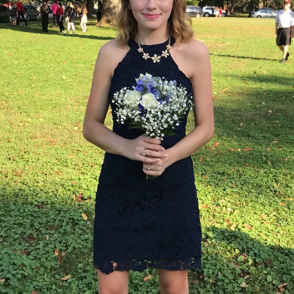 Tight lace Homecoming Dress